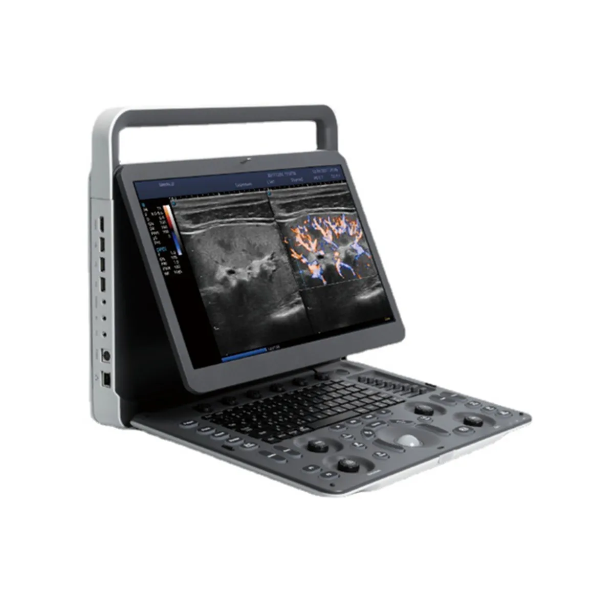 Sonoscape E2 smart ultrasound machine scan color doppler best price