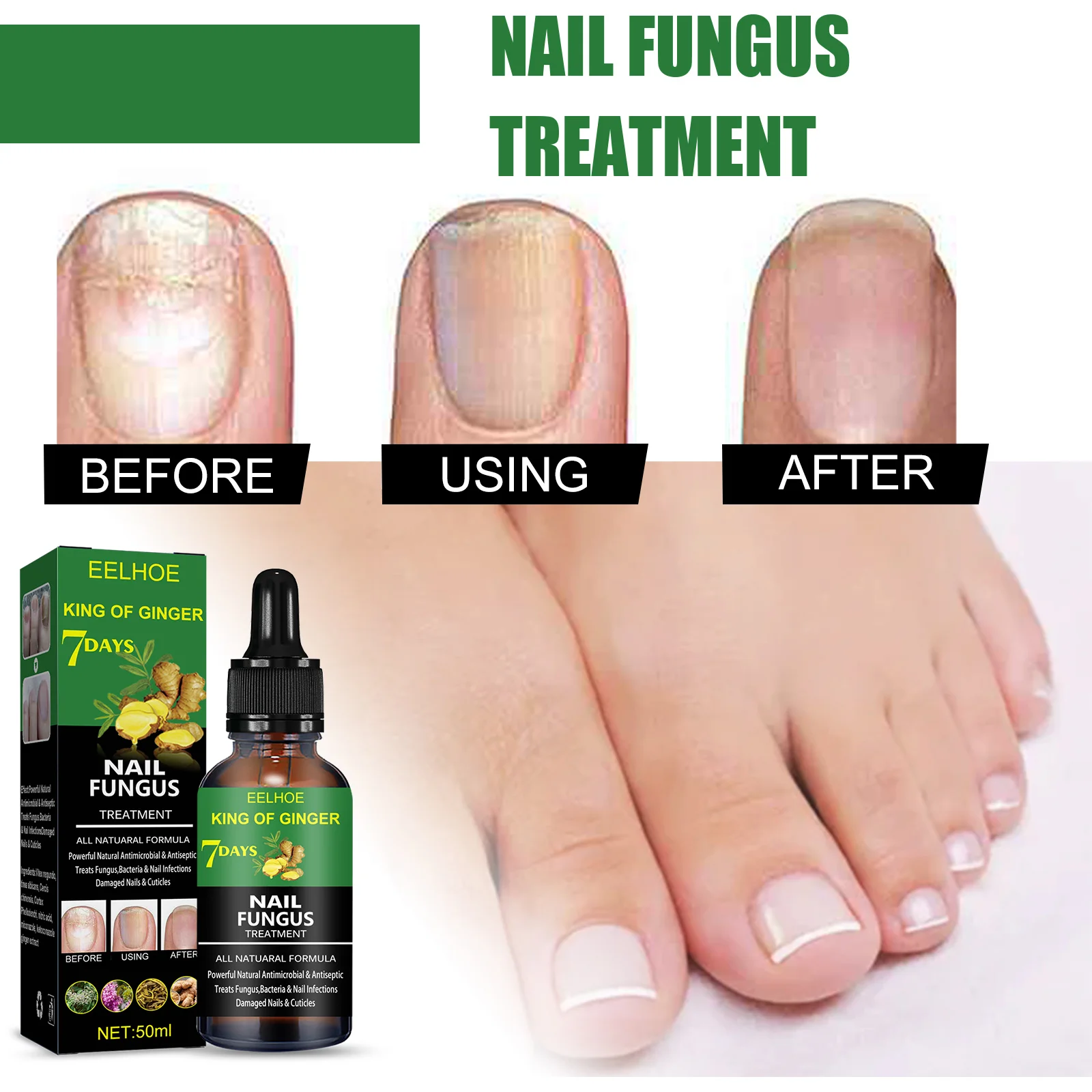 EELHOE 50ml New Herbal Care Hydrate Anti Fungal Nail Cream Quick Results Clean and Whiten Nail Repair Nail Fungus Treatment