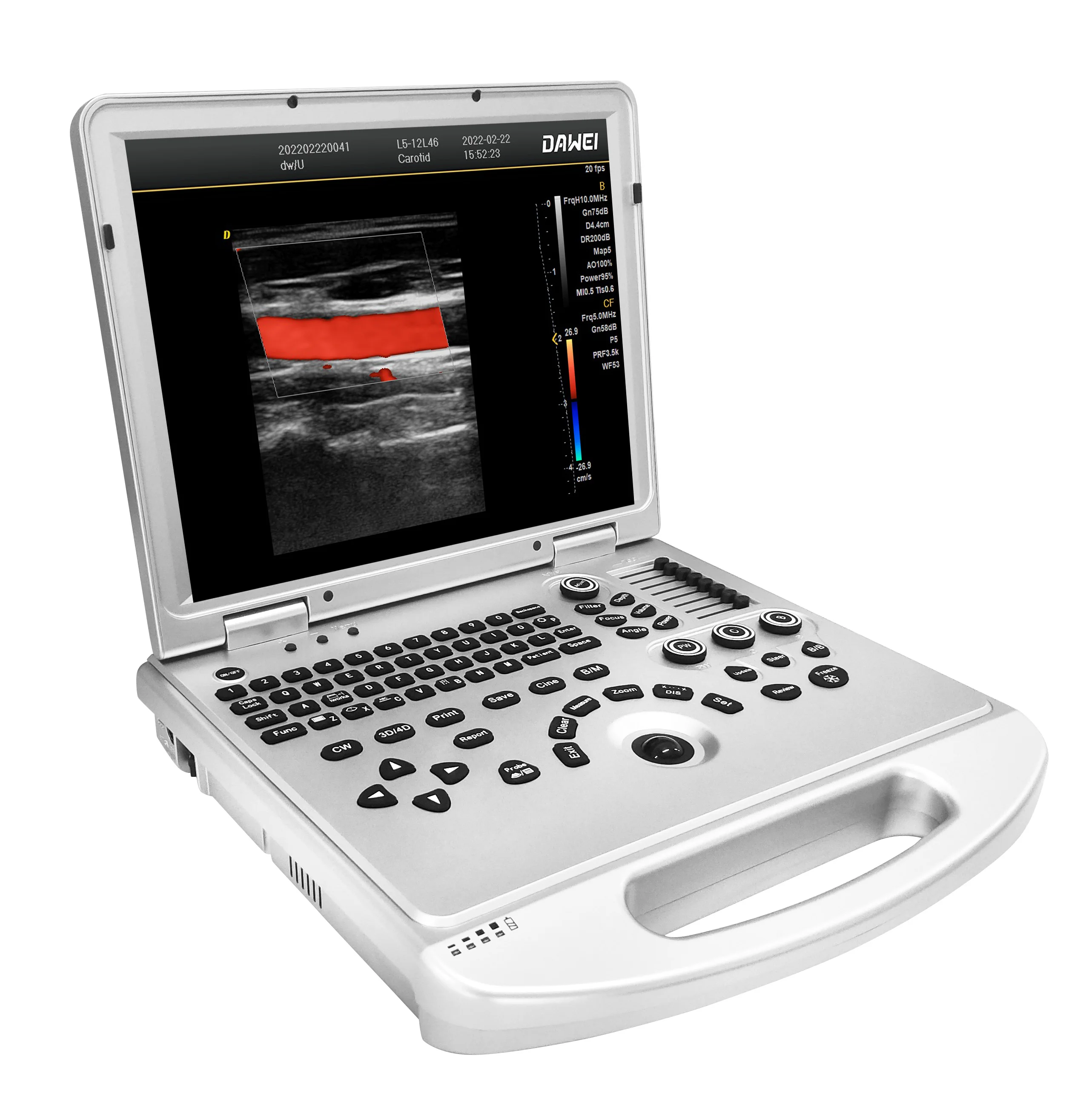 New 2D portable Color Doppler Human Gynecology echo ultrasound machine