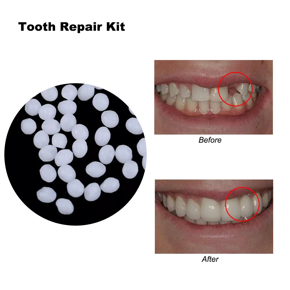 3Colors temporary Dental Oral False Fake Teeth Tooth Filling Repair Smile Snap on Veneers Dentures Case Paste Adhesive Beads