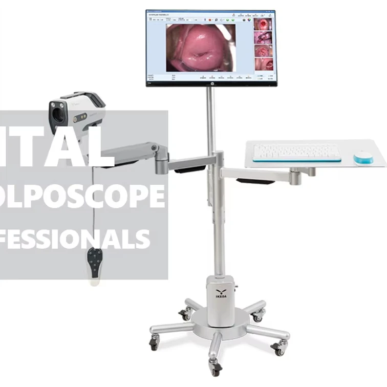 HD Hot Vagina Pictures Digital Colposcope Camera AKX YKD-3003