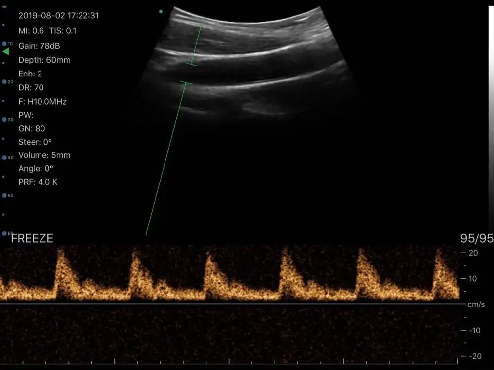 
5G Newest 3 in 1 Portable Echograph Factory Price Convex/Linear/Cardiac Ultrasound Scanner 