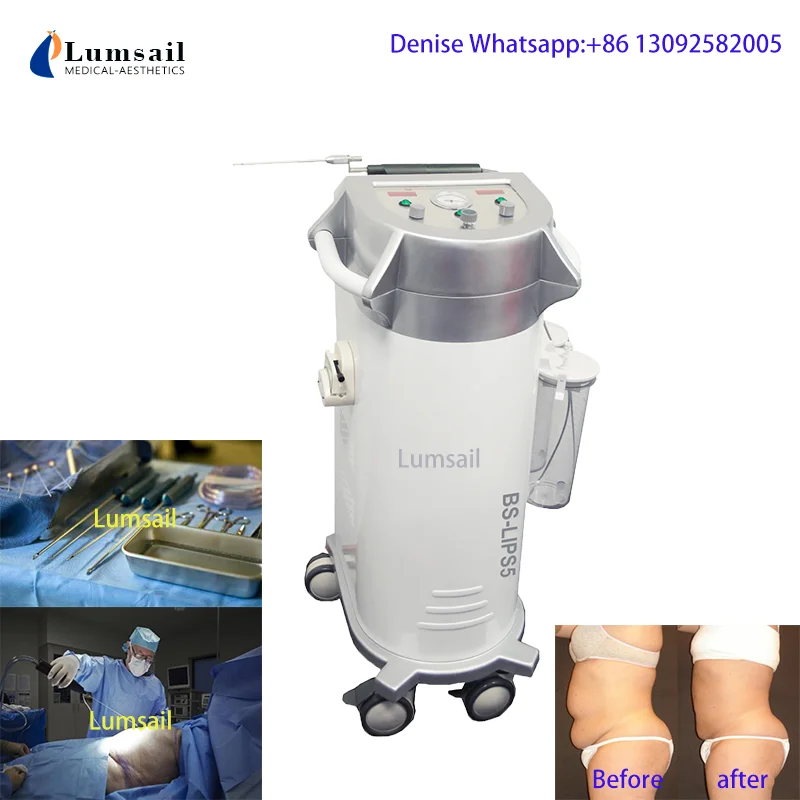 Laser Liposuction Fat Removal Machine SmartLipo For Plastic Surgery Hospital