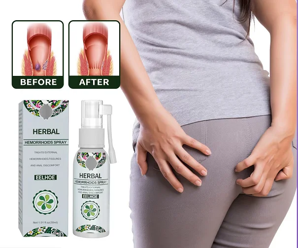 100% Natural Herbal Removal Ball Hemorrhoids Spray Powerful Hemorrhoids Treatment Agent Relieve Anal Pain Hemorrhoids Spray