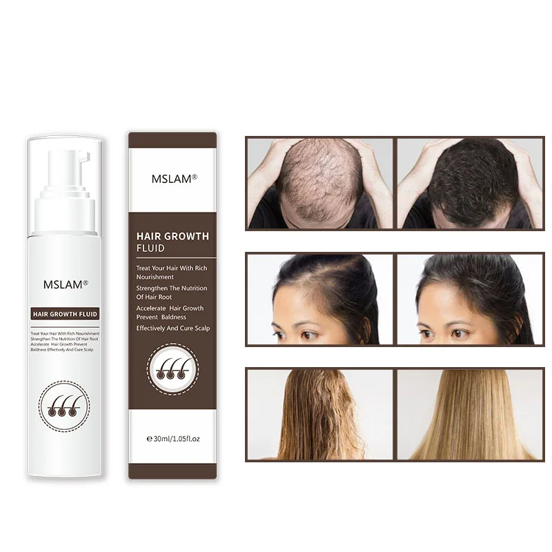 In Stock MSLAM Prevent Hair Loss and Fast Hair Growth Liquid habel Extracts Hair Regeneration Treatment