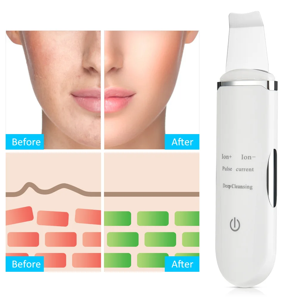 Acoustic scalpel EMS pulse ion skin rejuvenation introduction instrument facial pore cleaning beauty instrument