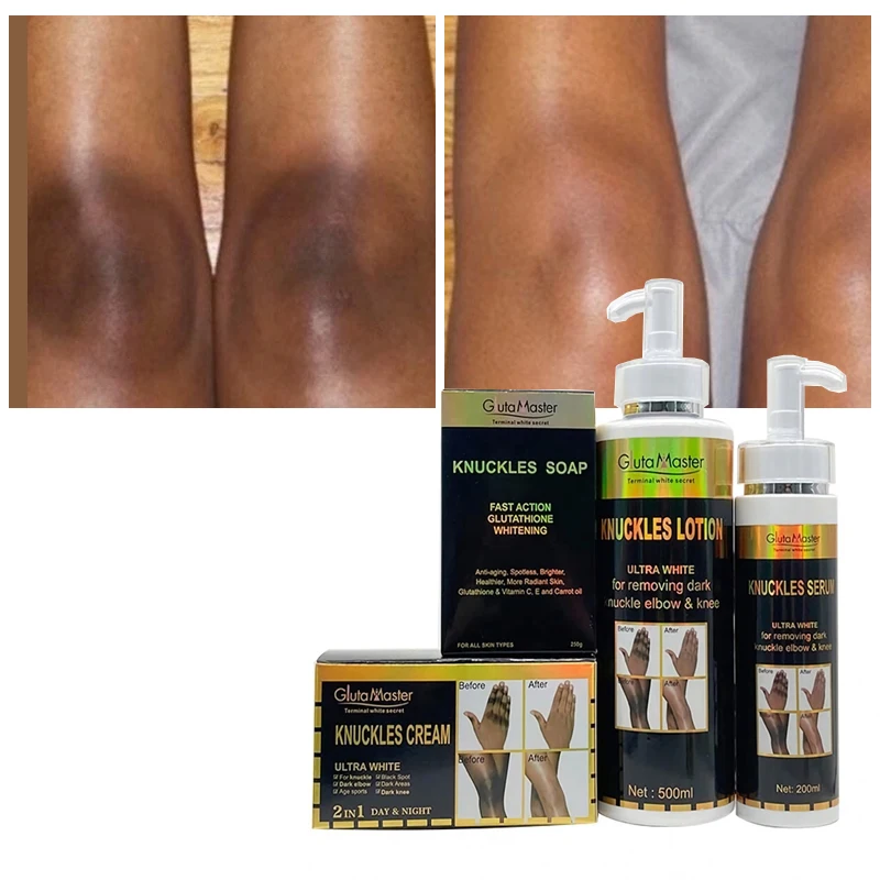 OEM Skin Care Set Knuckle Toes Elbow Bleaching Kit Soap Serum Body Lotion Cream 7 Days Whitening Skin Care Set Private Label