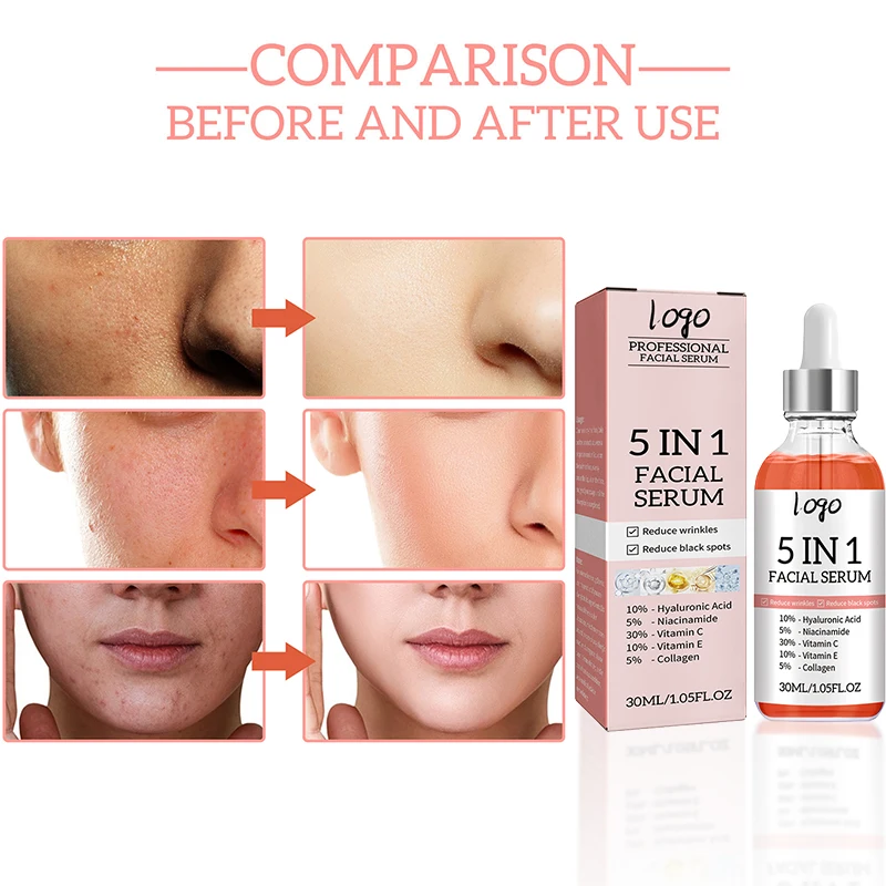 Face Serum Naturals Vitamin Topical Hyaluronic Most Complete Professional Grade Treatment 5 In 1 Serum