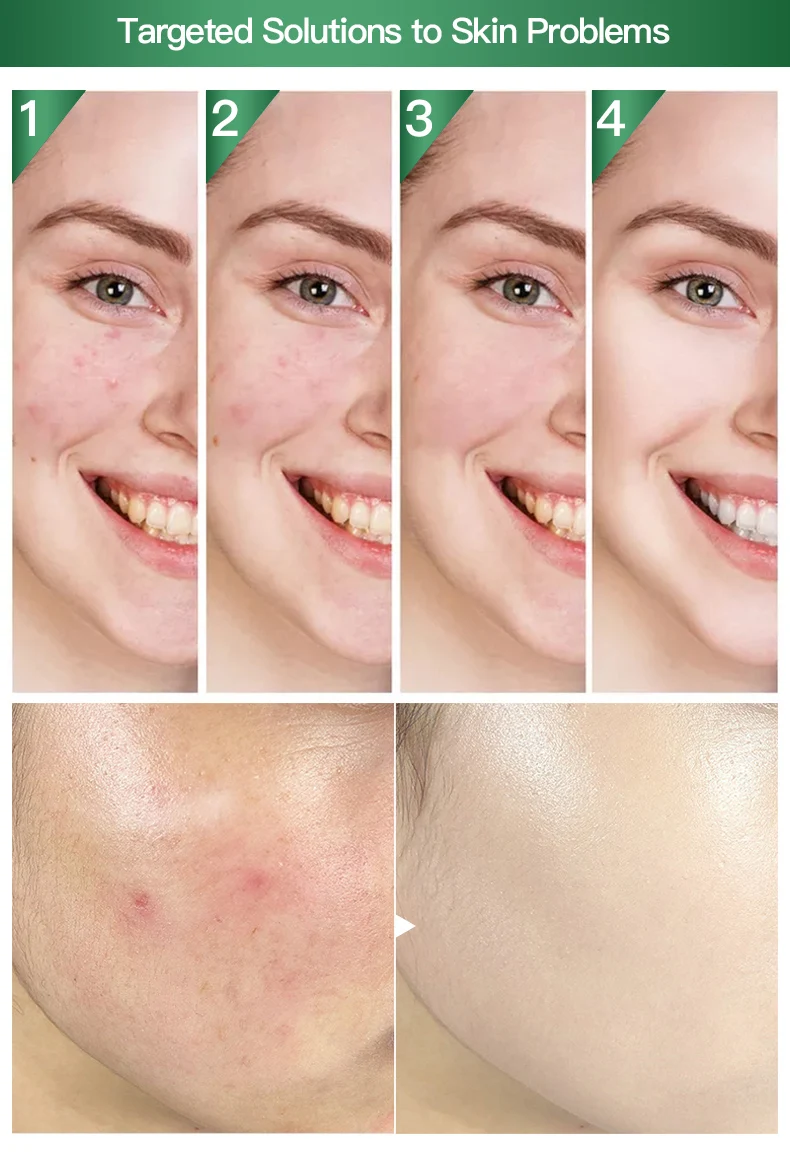 Growth factor Repair Skin Care sensitive skin Oligopeptide Serum