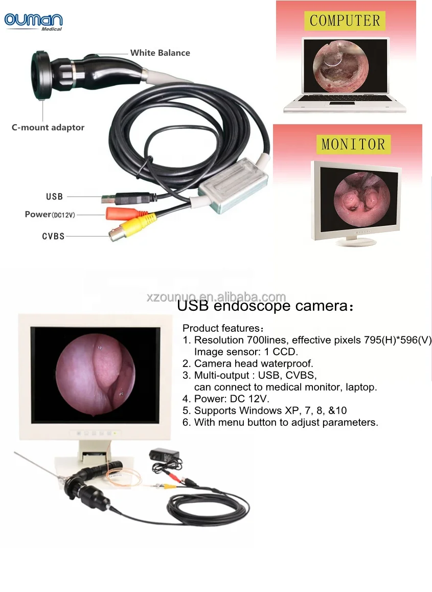 USB Portable endoscopy camera For All Endoscopic surgical