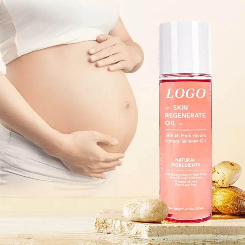 Aixin Private Label Natural Organic Stretch Body Oil Repair Hydrates Stretch Marks And Scar Removal Oil