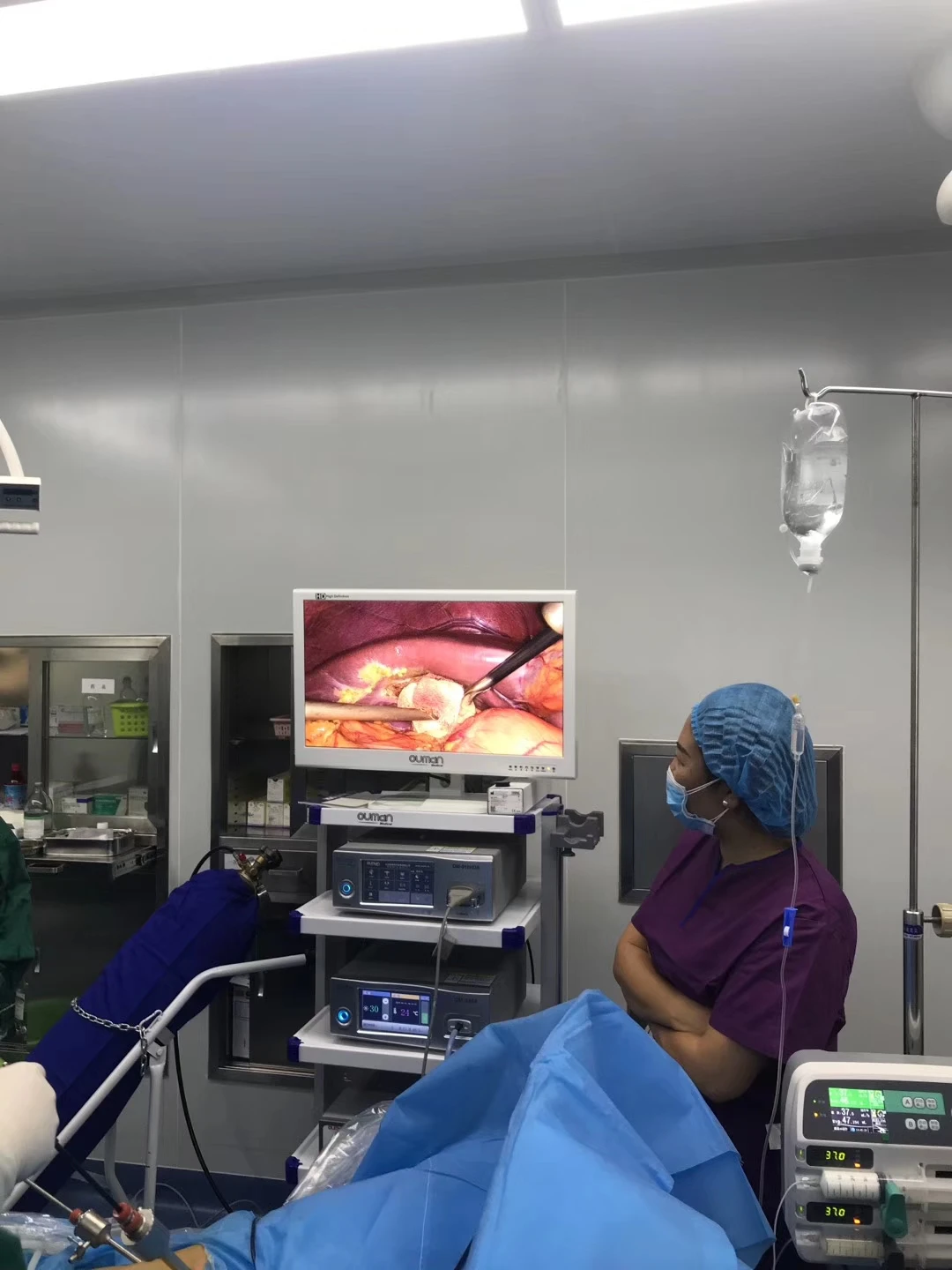 UHD camera endoscopy 4k medical surgery associated equipments for laparoscopic price