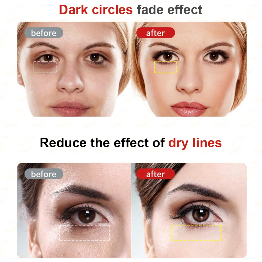 Eye massager (6).jpg