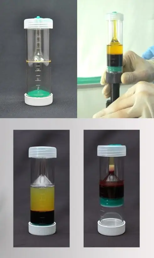 Biojoint High efficiency PRO Negensis Pure 10ml 20ml 30ml 50ml 60ml PRP platlet Rich Plasma kits centrifuge