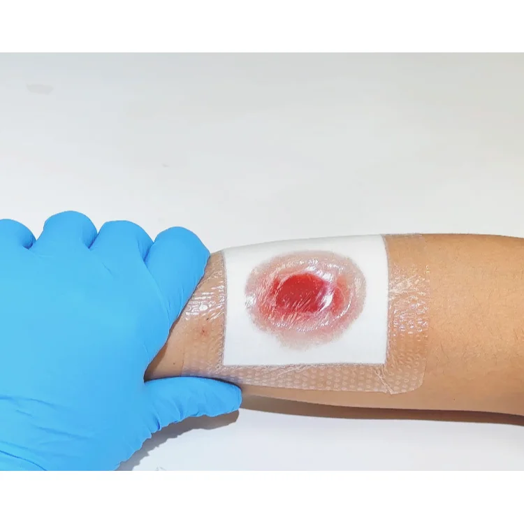 HENSO CMC Silicone Cellulose Gelling Fiber Wound Dressing White