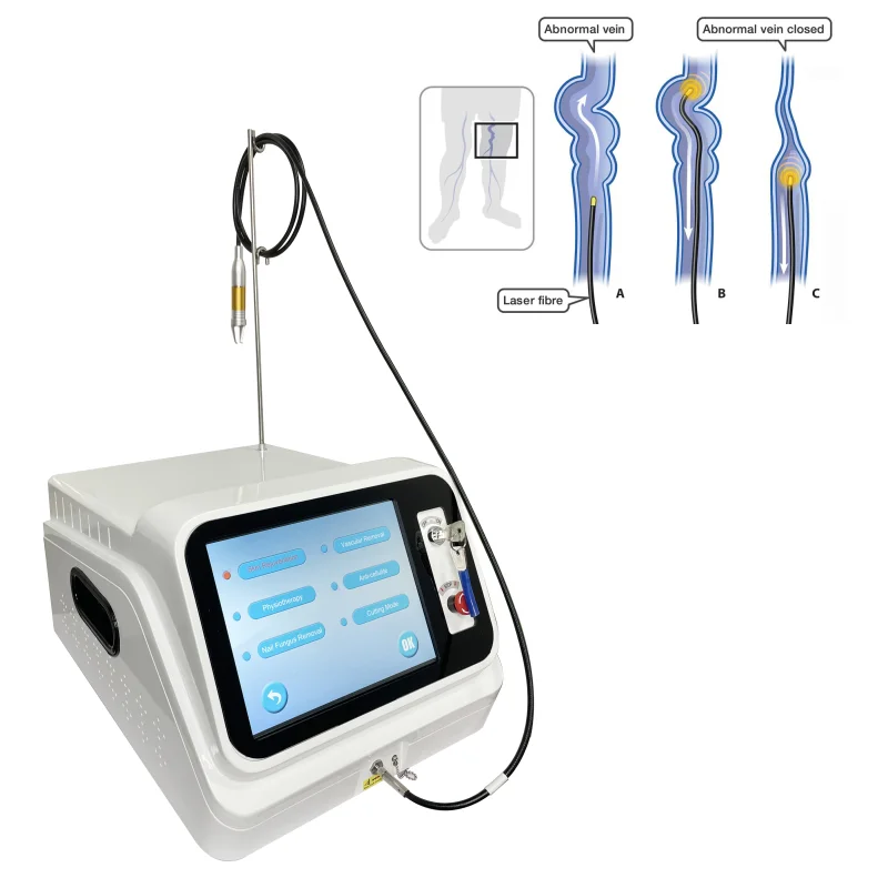 Leg Vein Varicose Removal Treatment 980nm 1470nm dual wave Diode Laser For Vein Care Medical equipment vascular treatment