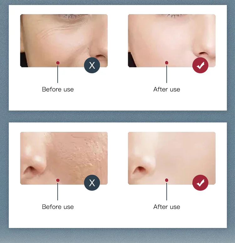 Portable pdt 7 color led anti aging light therapy Cold Spray beauty machine