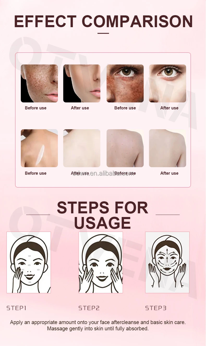 OEM Milk Dark Skin Whitening Cream High Performance Brightening Facial Cream Without Side Effects