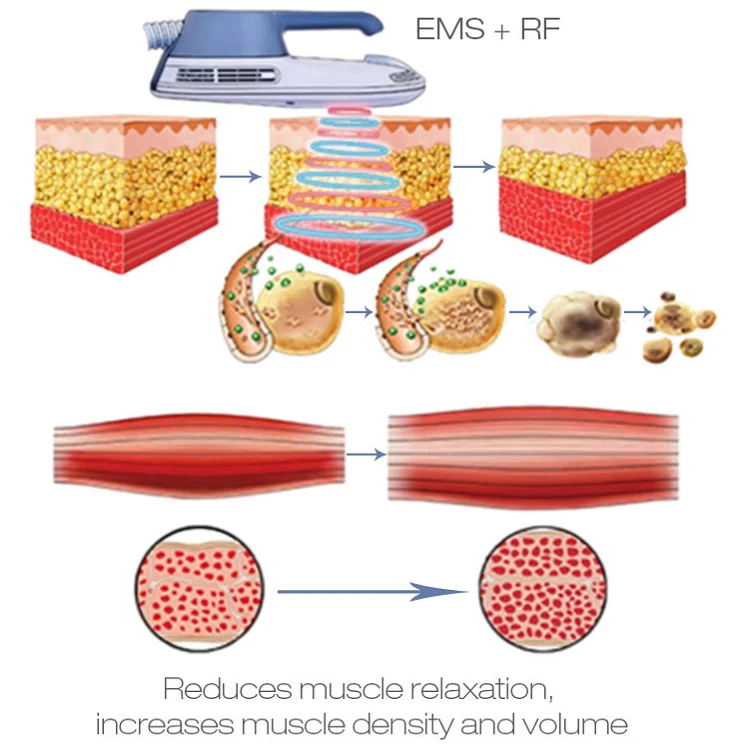 EMShaping elctromagnetic stimulate muscle ems rf machine hiemt for building muscle body contouring buttock lifting