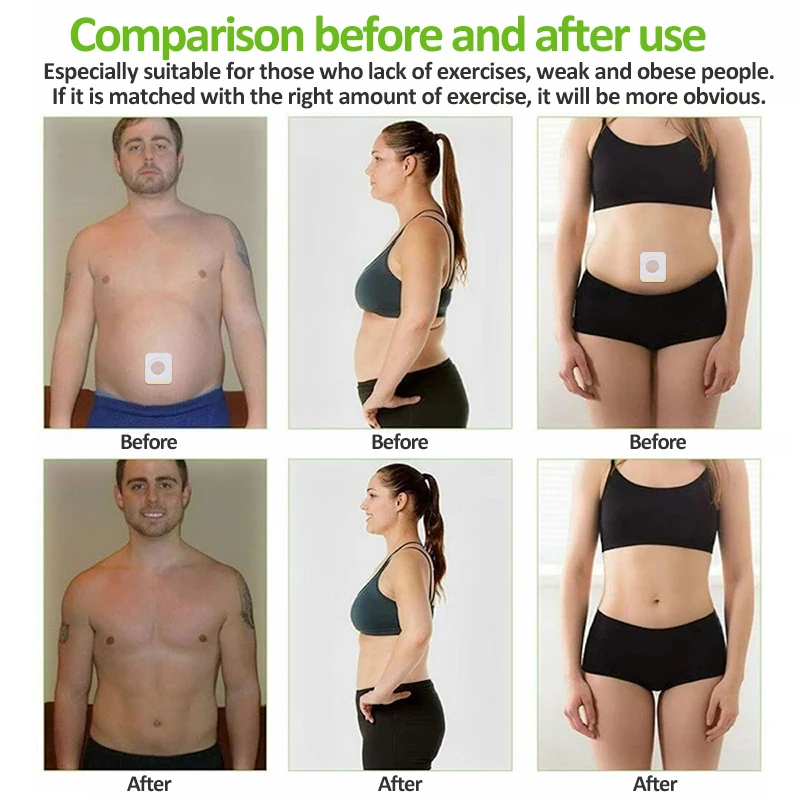 China Factory Extra Strong Weight Loss Products Body Detox Navel Slim Patch For Fat Burning