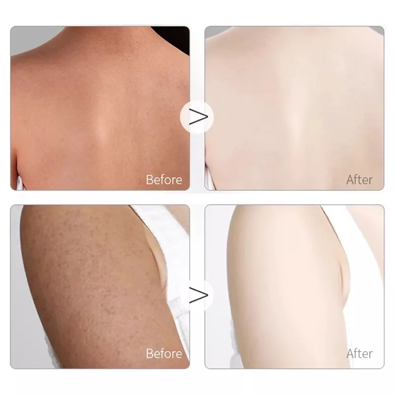 Shuboya Factory Custom Organic White Body Lotion Remove Spots Body Cream Moisturizing Milk Whitening Body Lotion For Black Skin