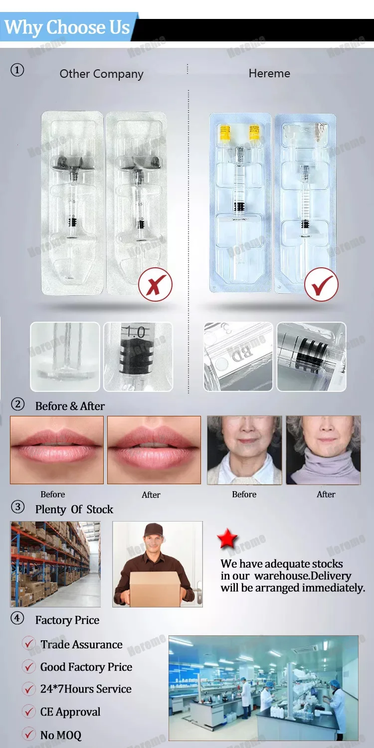 Wholesales Price 24mg/ML Ha Dermal Filler Injection Cross Linked Hyaluronic Acid Korea Dermal Filler