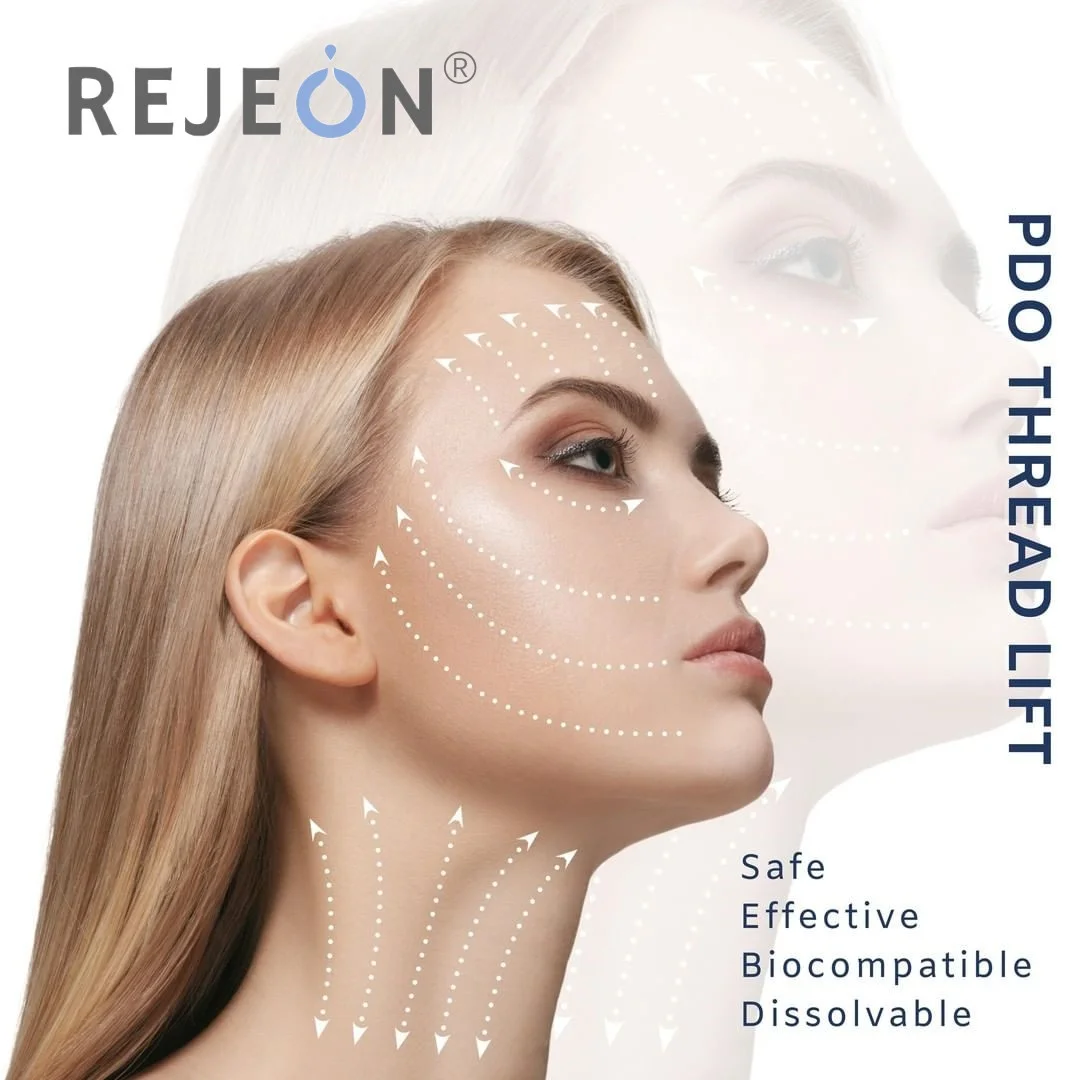 REJEON korea pdo threads molding cog 4d fios pdo thread cones cog w sharp both jaw cheek neck coreanos minerva thread 19g 100mm