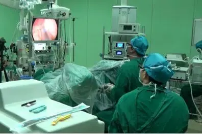 Manufacturer 60W System  Urology Endoscope Surgery lithotripsy BPH Cutting Tumors Resection lithotripter Holmium Laser