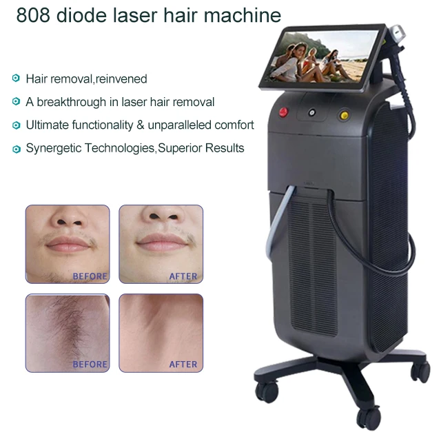 Лучшая модель 2022 года, титановый диодный лазер Almasop Ice с 3 длинами волны, 755, 808, 1064, сверхэффективная машина для удаления волос, 1600 Вт, для продажи