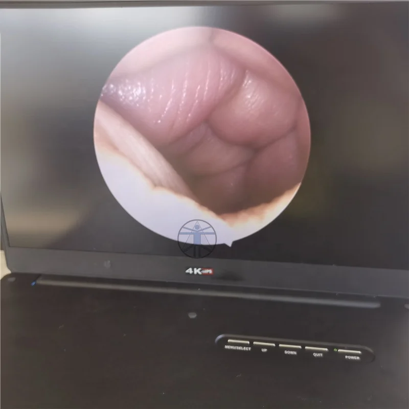 HD medical endoscope camera transforaminal endoscope spine endoscope camera