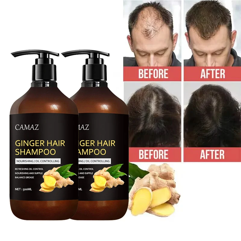 Private Label OEM Ginger long hair growth Shampoo Nature Organic african hair shampoo conditioner