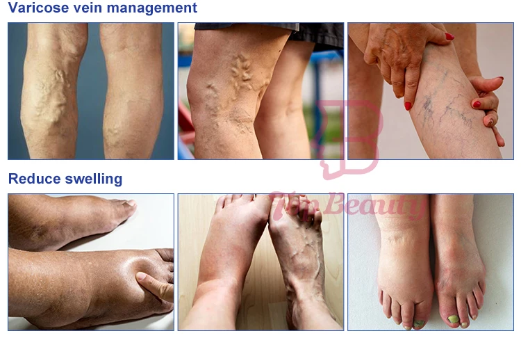 Far Infrared professional compression pressotherapy for feet and legs