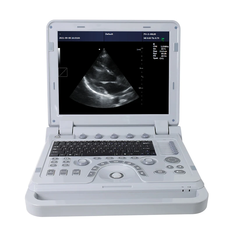CONTEC CMS1700A Color Doppler USG Color Ultrasound Scanner Diagnostic Machine Systems Convex Probe