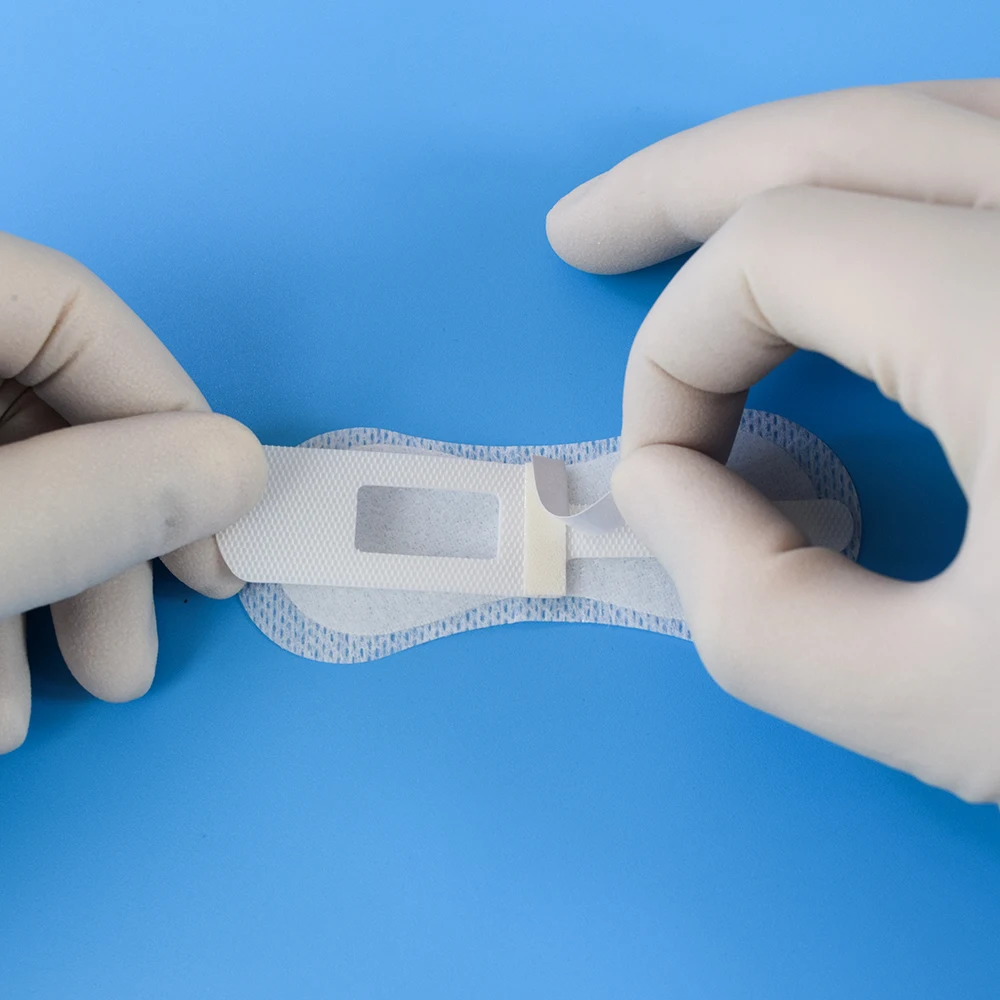 Wound Care Catheter Fixation Device For Children Catheter Fixing Device Indwelling Needle Fixation