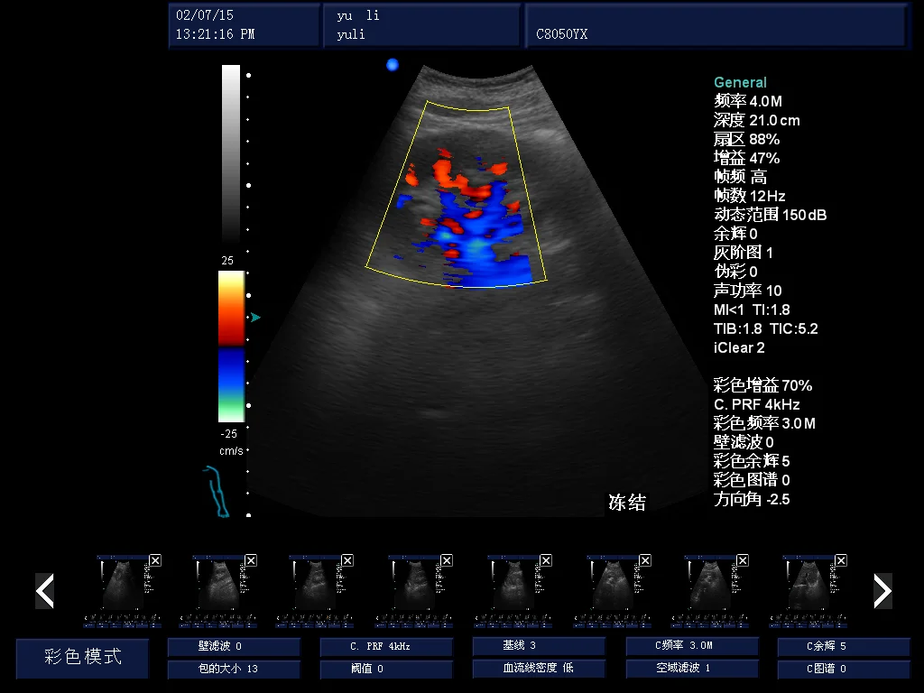RuiHua brand full digital Color Doppler Ultrasound trolley ultrasound manufacturer