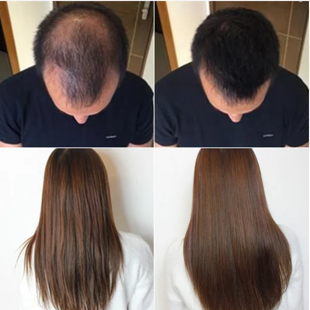 100% Pure Natural Cold Pressed Organic Black Cumin Seed Oil In Bulk - Wholesale Price -for Skin, Hair, And Health Care, Immune