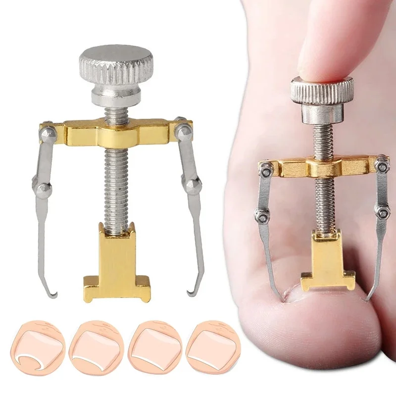 
Tool Ingrown Toenail Corrector Pedicure Toenail Fixer Foot Nail Care Orthotic Stainless Steel Treatment Onyxis Bunion Correction 