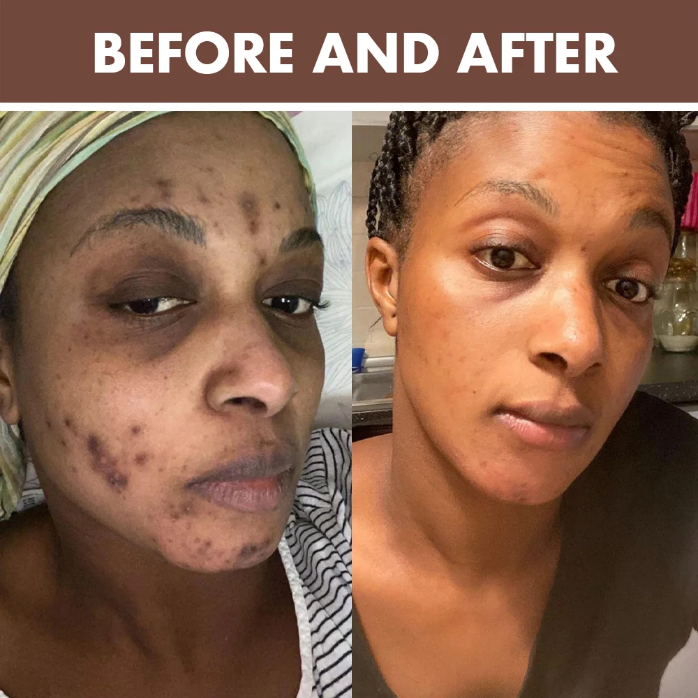 Caramel Skin Care Set Private Label Glowing Brightening Anti Acne Skin Face Toner Serum Facial Cream Body Lotion Skincare Set