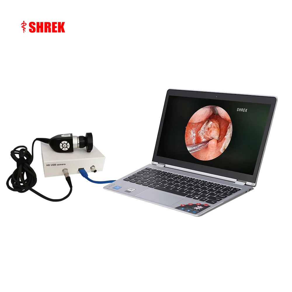 portable medical endoscopy hd usb endoscope camera for ent surgery system