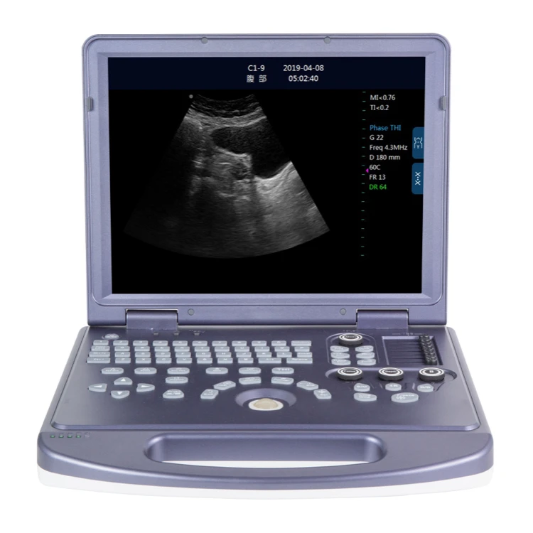Digital Ultrasound Scanner Cheap Linear Ultrasound Scanner Bondway Ultrasound Scanner Fetal