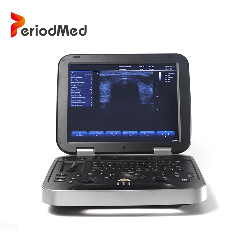 Periodmed medical equipment portable color doppler fetal with probes for clinic ultrasound