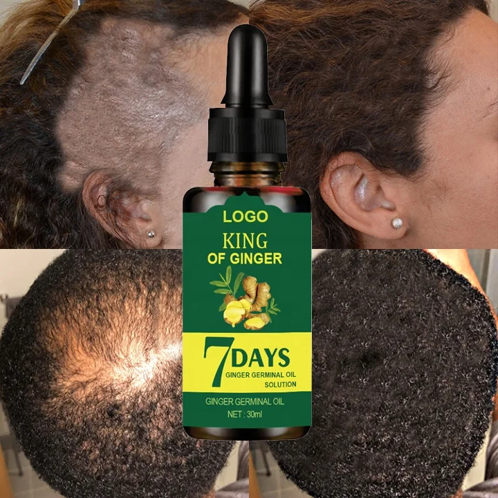 Private Label Natural Organic Hair Care Loss Treatment Serum Anti Hair Loss Promote Hair Growth 7 Days Ginger Essential Oil
