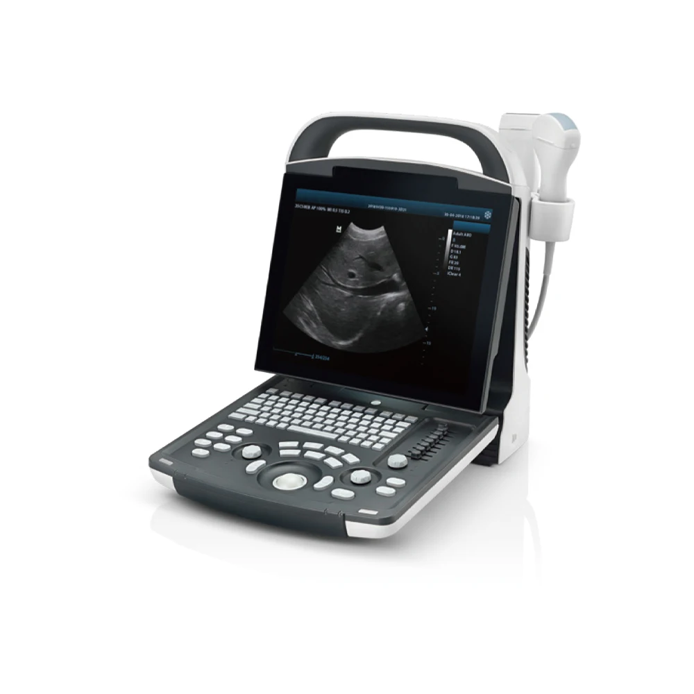 Mindray DP-10 full digital portable ultrasound diagnostic system black and white obstetric ultrasound for human