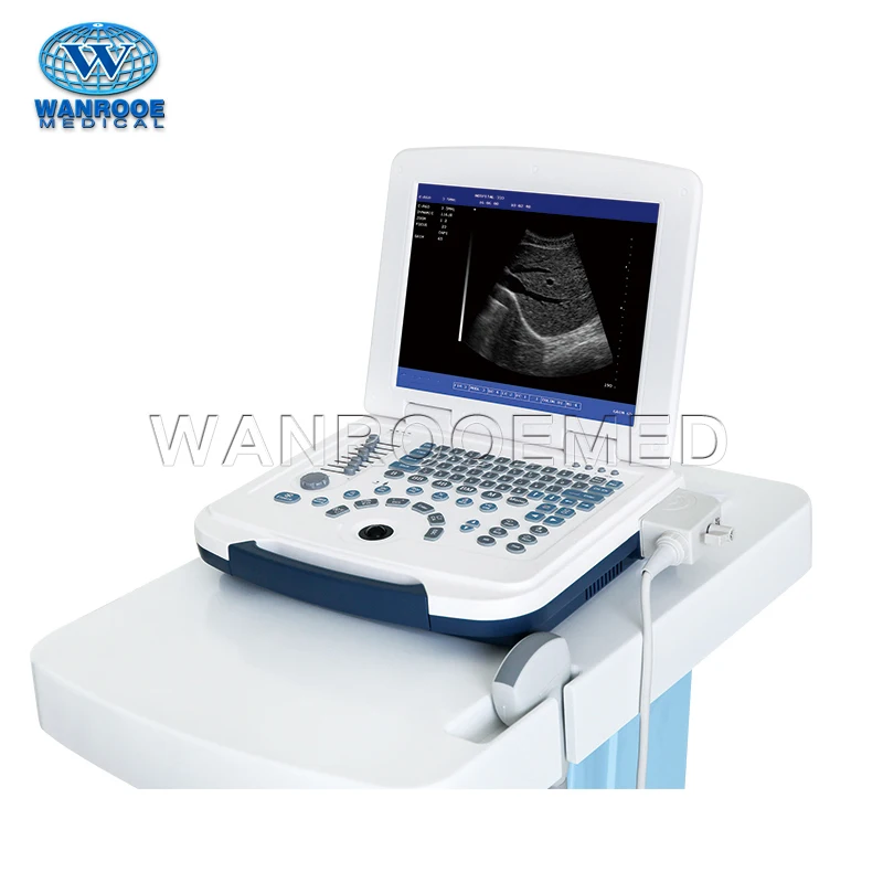 US580 Medical Mobile Laptop BW Diagnostic Ultrasound Scanner Machine Price