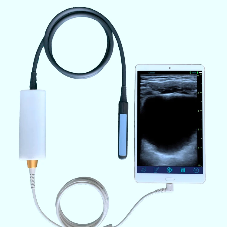 Ультразвуковая машина для прямотального проба крупного рогатого скота линейный прямотальный ветеринарный зонд ветеринарная ультразвуковая с прямотальным зондом