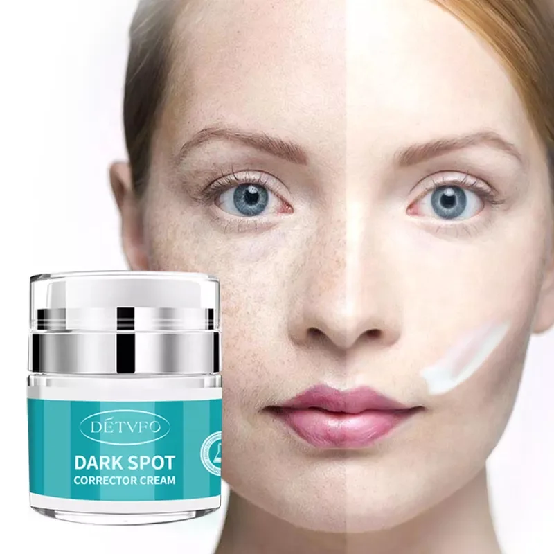 Face Whitening Freckle Remove Remover Lactic Acid Brightening Dark Spot Corrector Cream For Men Women
