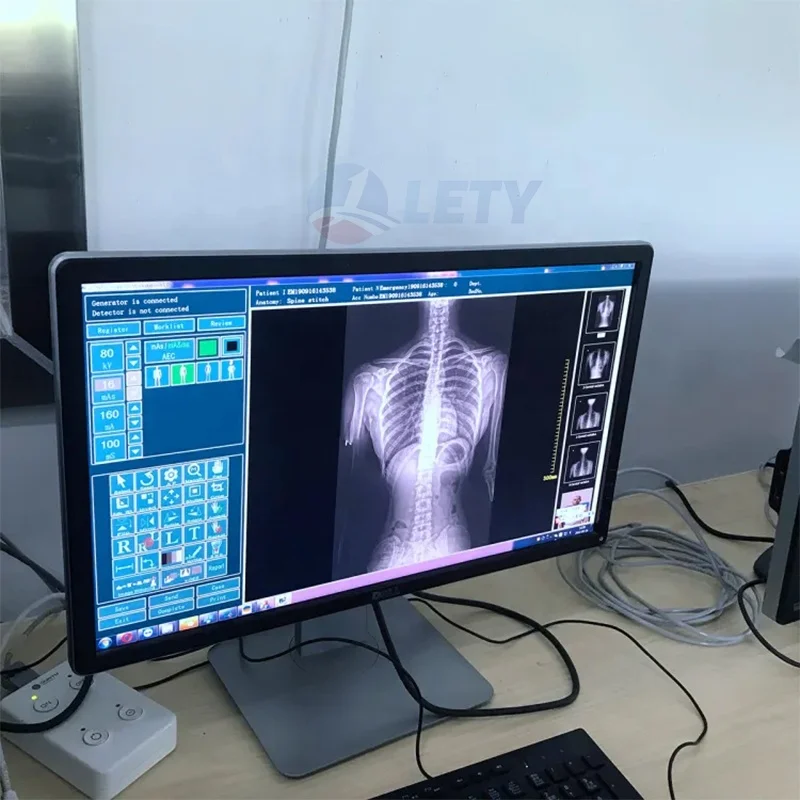 Portable X-ray Machine Veterinary X-ray portable x ray for pet with Touch Screen