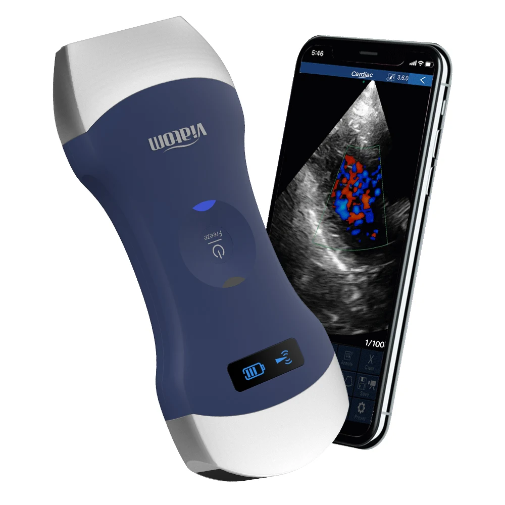 Viatom Wireless Probe Doppler Ultrasound Cardiac Scanner Wifi Color Doppler Ultrasound Scanner Machine Portable for sale