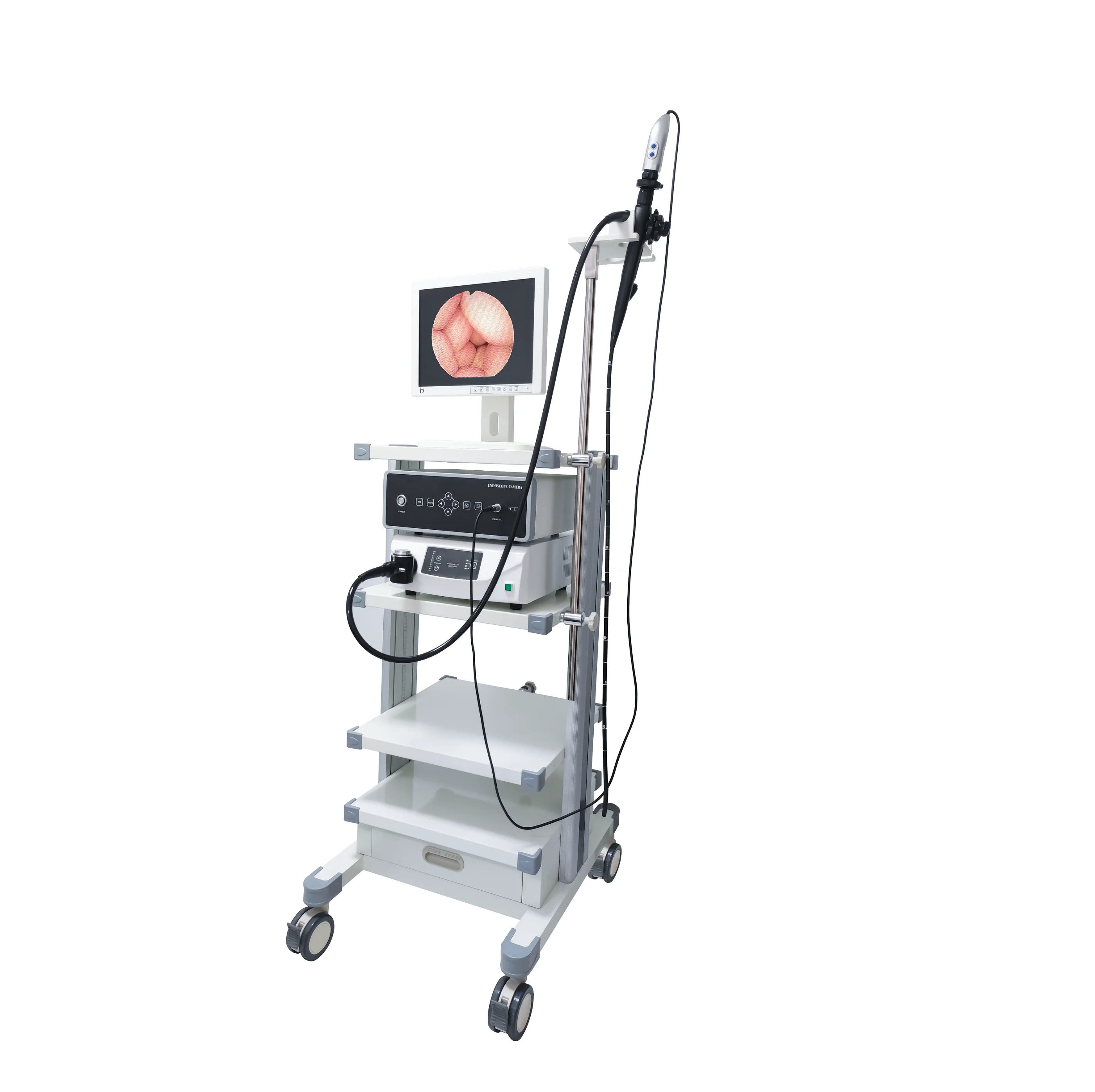 OJH Fiber Gastroscopy, Gastroscopy System, Fibro Gastroscopy