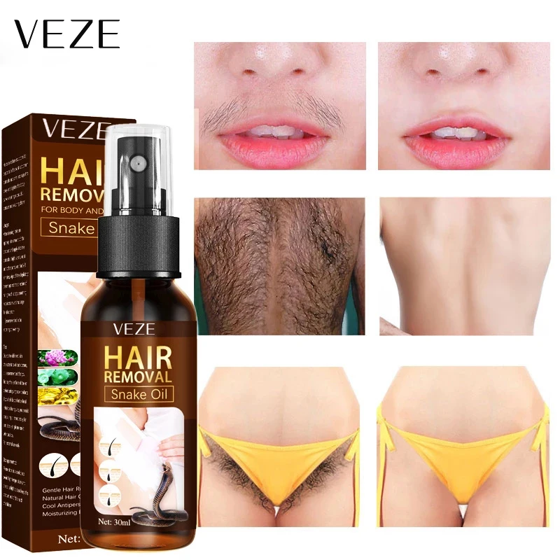 OEM VEZE частная этикетка оптовая продажа корейских постоянных волос удаление влажных для мужчин и женщин крем удаления сыворотка депиляционное
